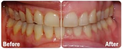 ProBiora Oral-Care Chewable Probiotic Tablets - Image 5