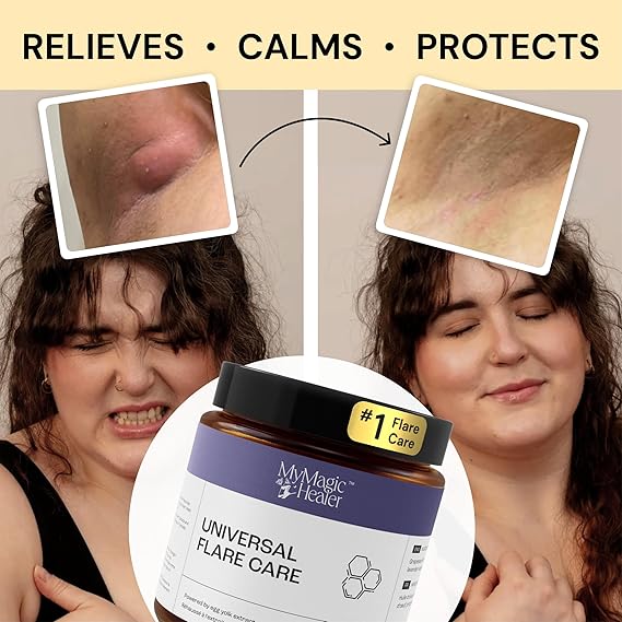 Universal Flare Care | Relief for 97% of Skin Issues - Image 3