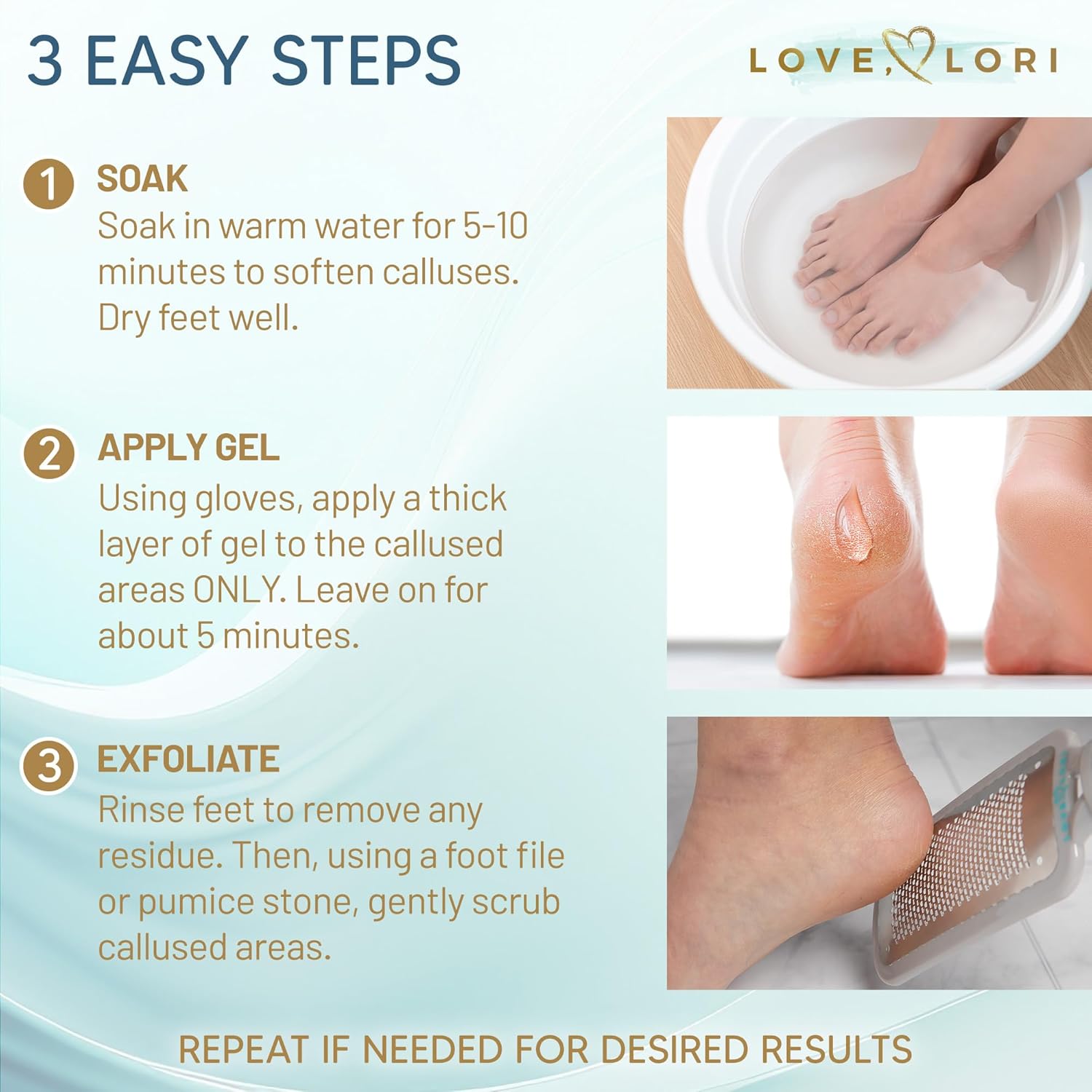 Callus Remover for Feet - Image 4